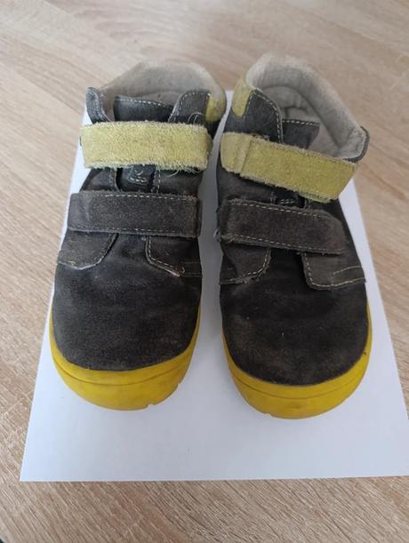 Barefoot protetika, protetika,31