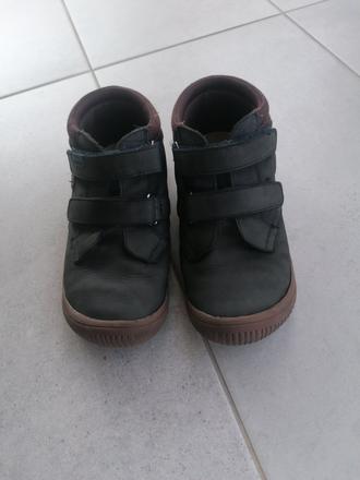 Prechodné protetika, protetika,35