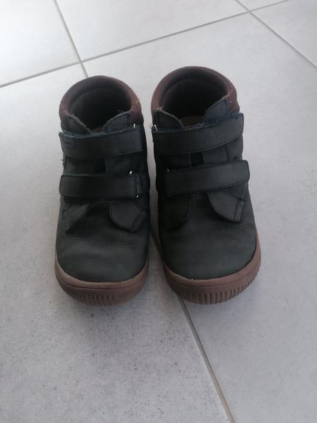 Prechodné protetika, protetika,35