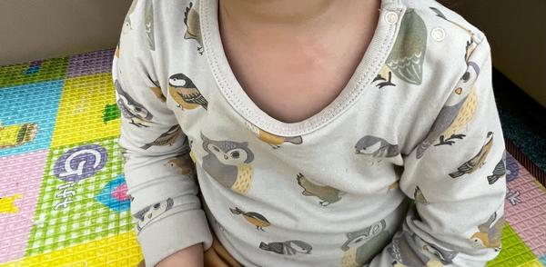 Aký hnedý flak má môj syn na krku?