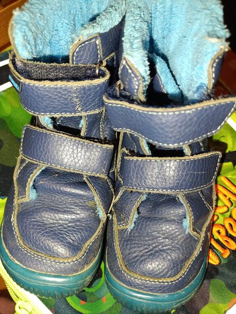 Protetika zimna barefoot, protetika,30