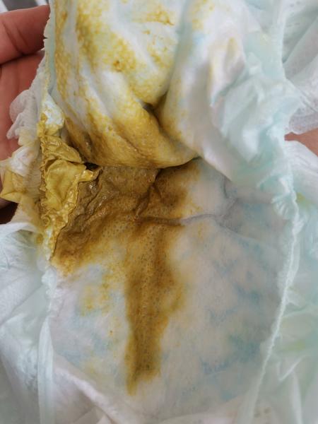 Synček už tretí deň čudne kaká