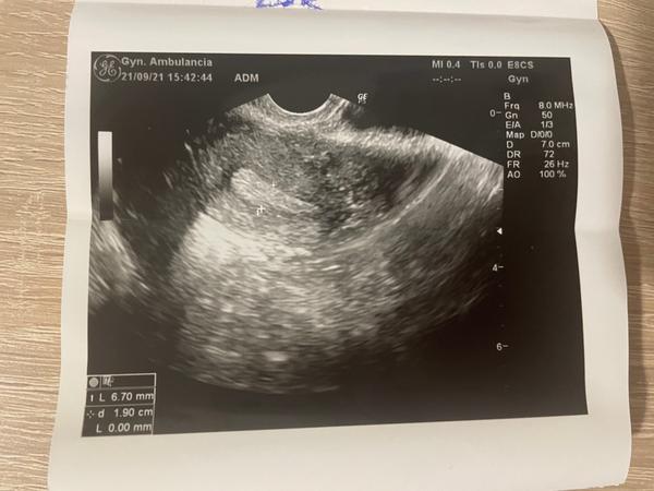 Aký problém je vidieť na fotkách zo sona?