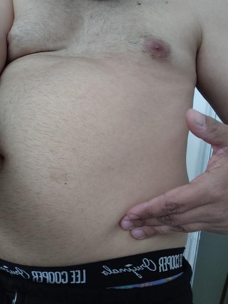 Je bolesť chrbtice spôsobená aj dýchaním?