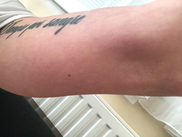 Kde mám hľadať príčinu svojho problému s rukou?