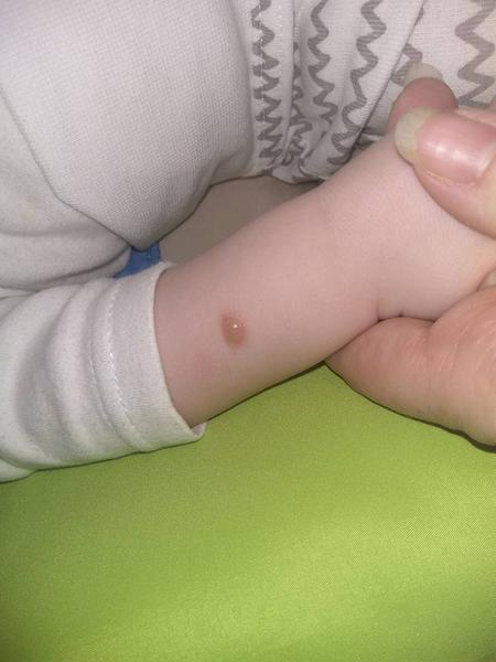 Problémový pľuzgier