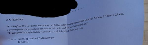 Skúsenosti s cystami v prsníkoch