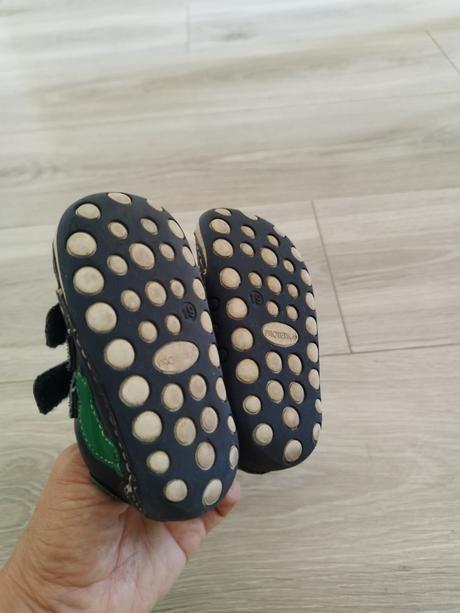 Kožené tenisky, protetika,19