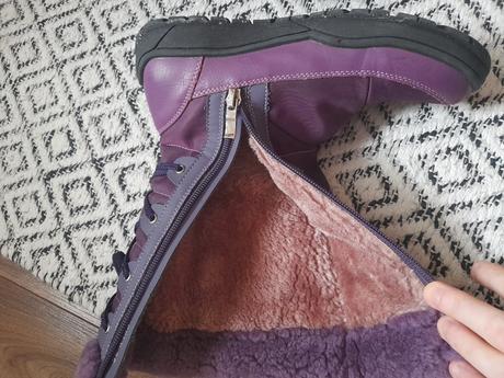 Cizmicky protetika, protetika,35