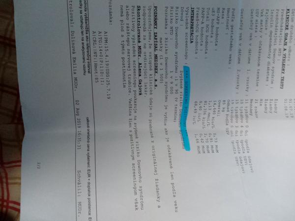 Dawnov syndróm - nerozumiem tomu.