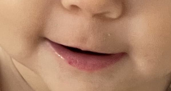 Čo znamená červená bodka na pere dieťaťa?