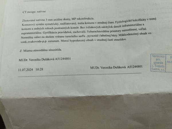 Aký je význam výsledku CT mozgu?