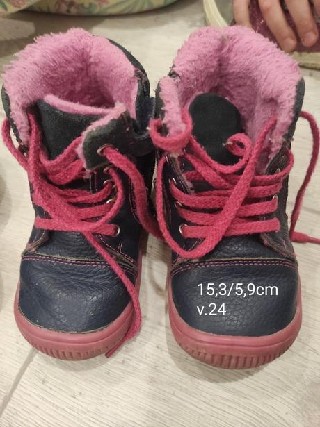 Zimne  barefoot, protetika,24