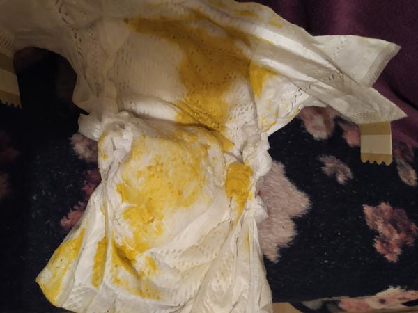 Je to hnačka u bábätka?