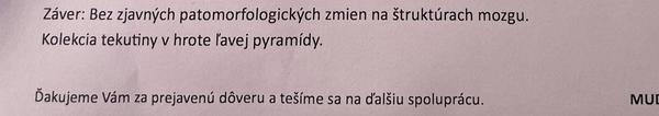 Skúsenosti s magnetickou rezonanciou mozgu a cystou?