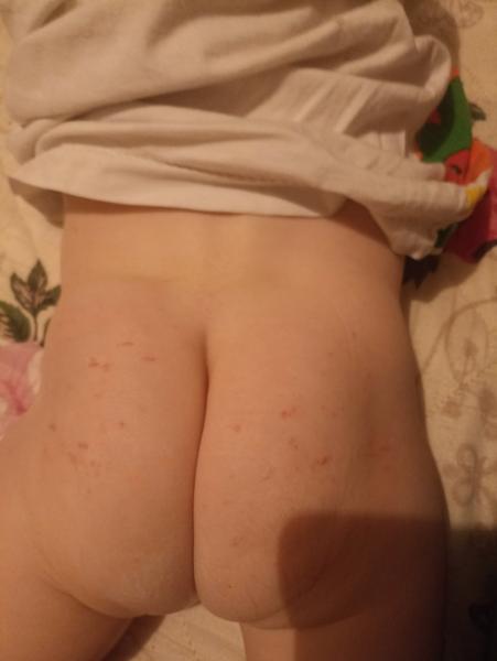 Možné príčiny svrbenia: Ako pomôcť?