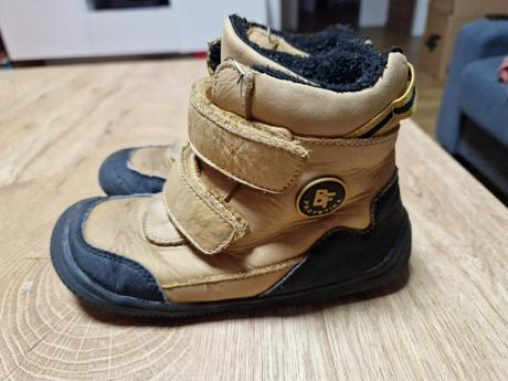 Barefoot protetika, protetika,28