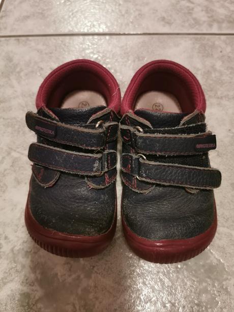 Protetika bf topanocky, protetika,22