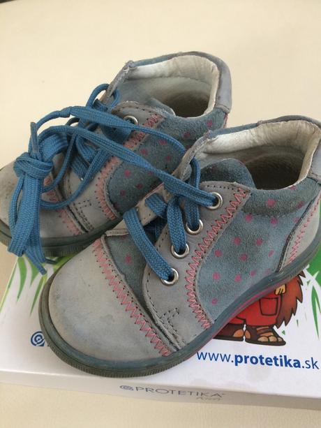 Prechodné topánky protetika, protetika,21