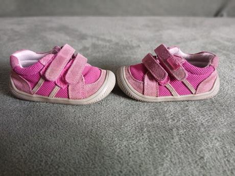 Dievčenské topánočky, protetika,21