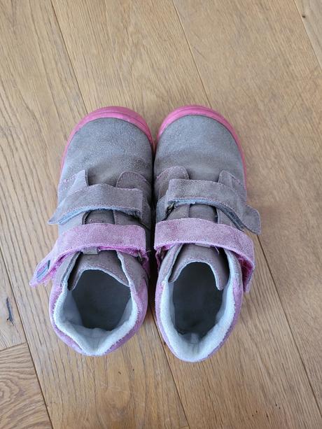 Topanky protetika, protetika,31