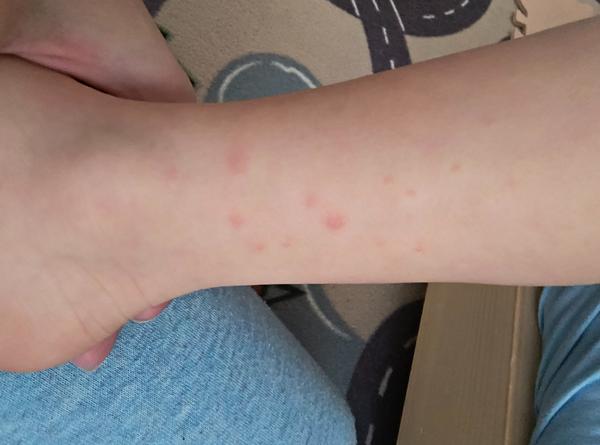 Má môj syn kiahne?