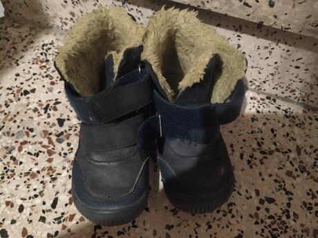 Zimne barefoot protetiky, protetika,27