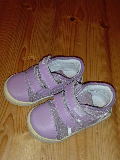 Topánočky, protetika,21