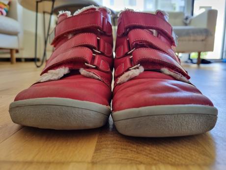 Beda zimne topanky, beda,33