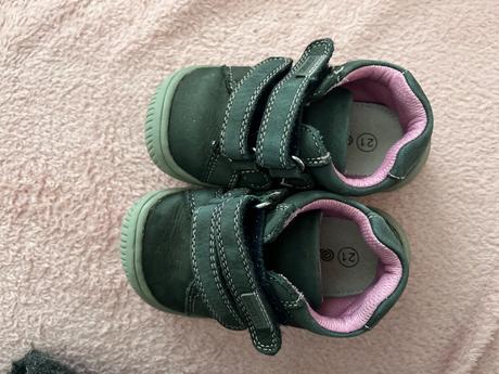 Protetika, protetika,21