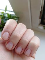 Prečo mám čiaru na nechte?