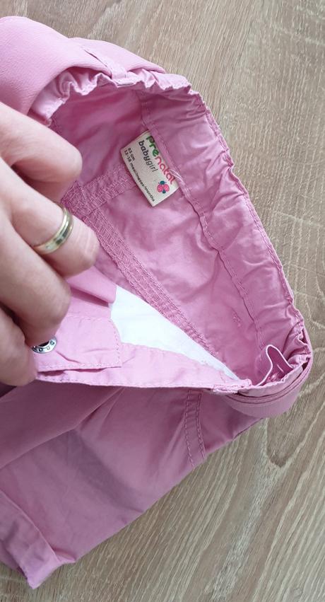 Platene kratasky, prénatal,86