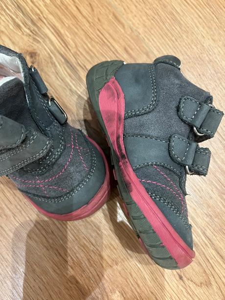 Topanky, protetika,21