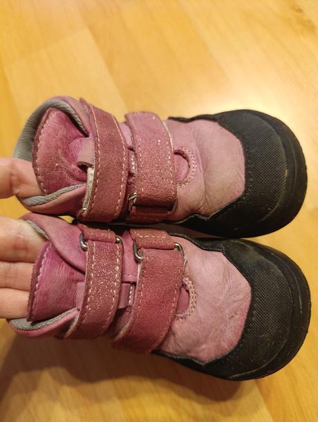 Protetika celoročné topánky, protetika,23