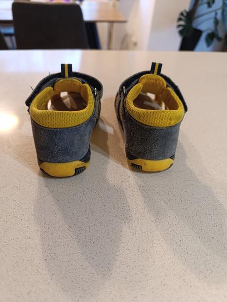 Sandálky protetika, protetika,20