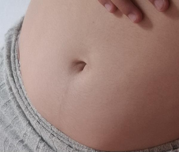 Čo znamená čiarka od pupka a ako ju odstrániť?