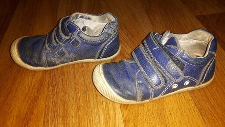 Topánky protetika, protetika,25