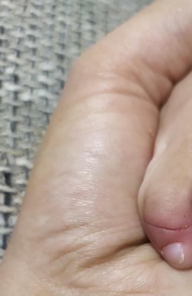 Čo to má môj synček na prste?