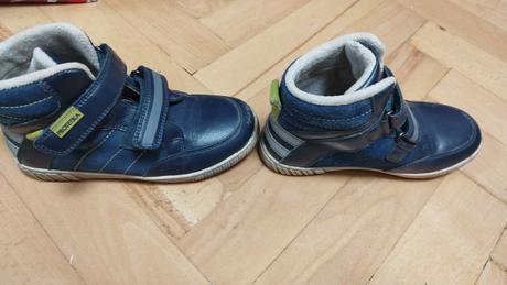 Zimne topanky, protetika,33