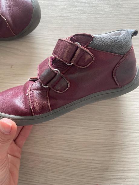 Prechodne topanky, protetika,29