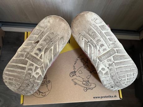 Zimne topanky protetika barefoot, protetika,32