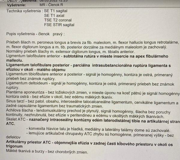 Je môj výsledok z MRI členku v poriadku?