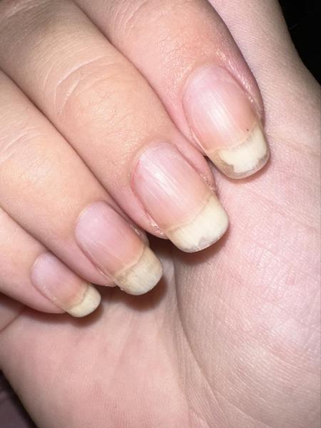 Ako vylepšiť zdravie vašich nechtov?