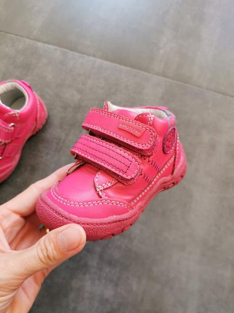 Topánky protetika, protetika,19