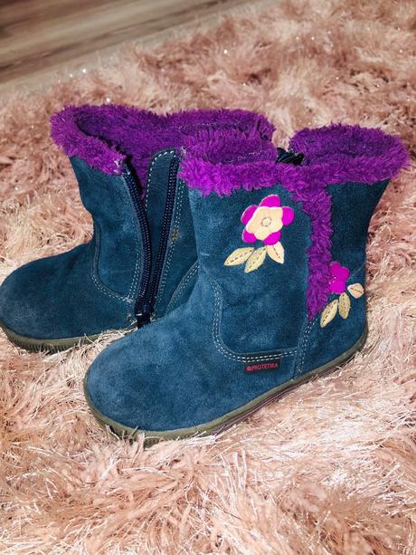 Semišove čižmičky protetika, protetika,23