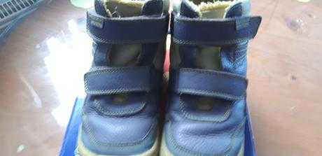 Zimná protetika topánky, protetika,31