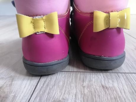 Topánky kotníkové protetika, protetika,33