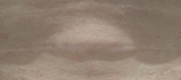 Pruh na jazve po sekcii