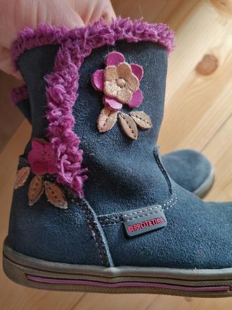 Čižmičky, protetika,21