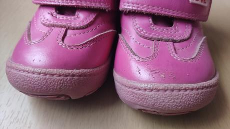 Zimné čižmičky protetika, protetika,22